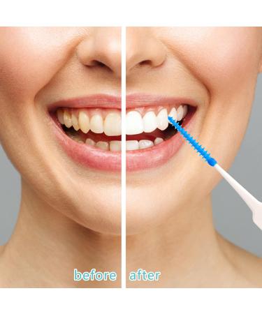 220-Piece Blue Silicone Interdental Brushes for Braces - Oral Cleaning Floss Picks - Buy Online on GoSupps.com