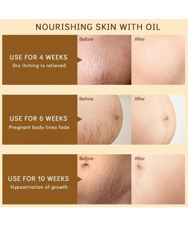 Emollient Oil Precious Oil for Soothing Moisturizes Face and Body Care 125 ml Skin Care Oil for Dry Skin Stretch Marks Scars - Buy Online on GoSupps.com
