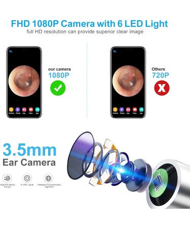 Ear Wax Removal Endoscope | BEBIRD HD Earwax Remover Tool with WiFi Camera & LED Lights | USB Rechargeable Ear Cleaner for Kids Adults & Pets - Compatible with iPhone iPad Android (Black - Buy Online on GoSupps.com