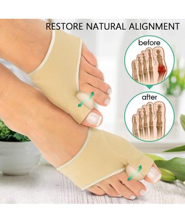 MinLia 1Pair Bunion Protector Orthopedic Splint with Gel Toe Spacer and Adjuster - S Small - Buy Online on GoSupps.com