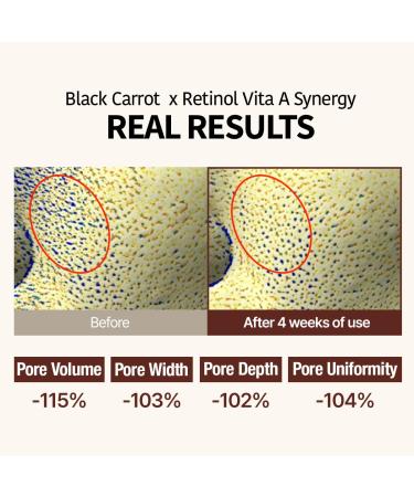 GOODAL Black Carrot VITA-A Retinol Ampoule 30ml Hydration Facial Serum for Glowy Skin Lightweight Serum Korean Skincare Pore minimizer - Buy Online on GoSupps.com