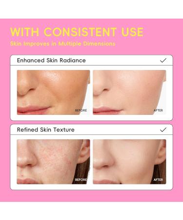 5-in-1 Face Toner for Skincare 100ml Facial Toner for All Skin Types Moisturizing & Refreshing 1 Fl Oz (Pack of 1) - Buy Online on GoSupps.com