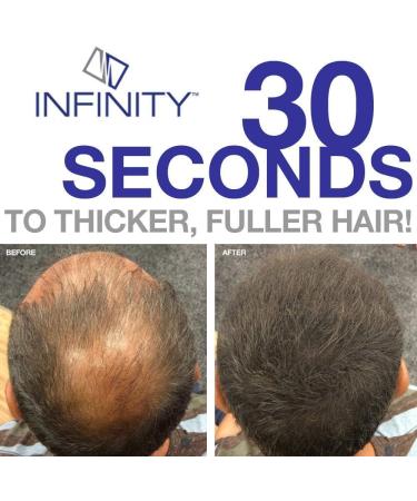 Infinity Hair Building Fibers Spray Applicator Pump - Professional Home Use for Men & Women - Buy Online on GoSupps.com