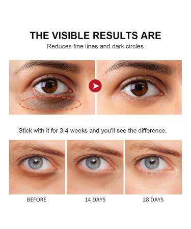 Retinol Eye Stick - Anti-Aging Under Eye Cream with Collagen & Hyaluronic Acid | Reduce Fine Lines & Dark Circles - Buy Online on GoSupps.com