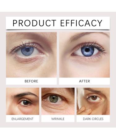 S rum Contour Des Yeux Au Th Vert Et la Niacinamide: R duit le Teint Terne Rehausse L' clat et Hydrate Durablement(1pcs) 1 g (Lot de 1) - Buy Online on GoSupps.com