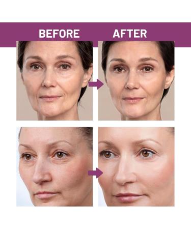 Calcium Multi Balm Anti-Aging Wrinkle Core Stick Collagen Moisturizing Stick Hydrating Calcium Volume Multi Balm - Suitable for Eyes Neck Face Portable Daily Use Wrinkle Reducing balm (1PCS) - Buy Online on GoSupps.com