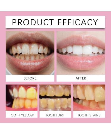 Mint Toothpaste - Daily Gentle Teeth Cleaning Removes Stains/Tartar Freshens Breath Brightens Teeth Easy to Use(2PCS) - Buy Online on GoSupps.com