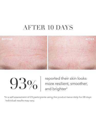 Algenist GENIUS Ultimate Anti-Aging Vitamin C+ Serum | Vegan Brightening Serum with Alguronic Acid & Microalgae Oil | Non-Comedogenic & Hypoallergenic Skincare 1 Fl Oz - Buy Online on GoSupps.com