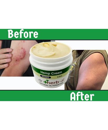 Buy Powerful All-Natural Hemp Skin Cream | Best Moisturizer for Healthy Skin | International Shipping Available - Buy Online on GoSupps.com