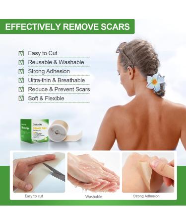 Silicone Tape for Scars - Soft Medical Tape for Keloid, Surgical, Burn, and Acne Scars - Tummy Tuck Post Surgery Supplies - 1.6 x 120 Roll - Buy Online on GoSupps.com