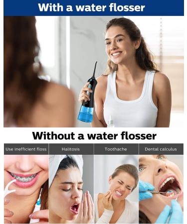 Professional Cordless Water Flosser with 3 Modes & 4 Jet Tips - IPX7 Waterproof Dental Oral Irrigator for Braces Gums - 300ml Tank - Home & Travel (Black) - Buy Online on GoSupps.com
