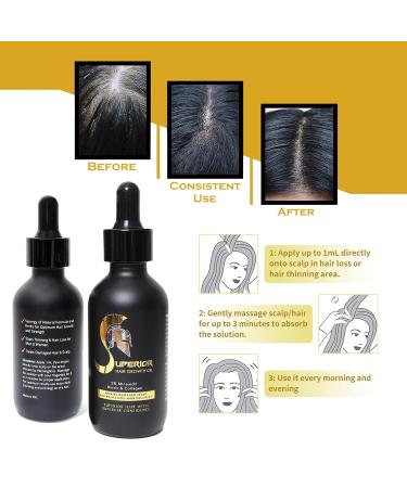 Hair Building Fibers + Hair Growth Oil with 5% Minoxidil Biotin Collagen - Thinning & Hair Loss Treatment - Medium Brown - Buy Online on GoSupps.com