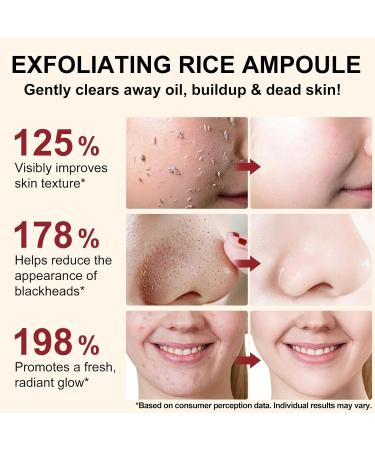 Peel Shot Glow Rice Peeling Ampoule S rum exfoliant doux pour le visage et le corps r tr cissement des pores et hydratation profonde pour tous les types de peau - Buy Online on GoSupps.com