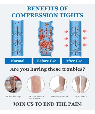 MGANG Medical Compression Pantyhose for Men & Women - Footless Waist High Support Stockings 15-20 mmHg Opaque Compression for Edema & Varicose Veins Black L - Firm Support Hose - Buy Online on GoSupps.com