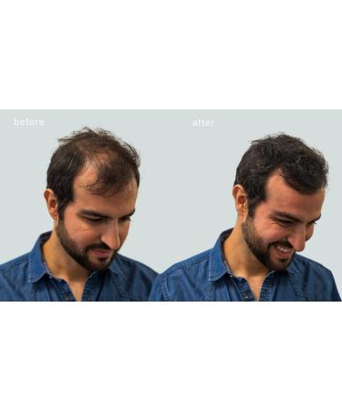 MAXX PRO Series Volumizing Hair Fibers with Real Keratin | Hypoallergenic & Dermatologist Tested | 60 Days Supply for Hair Loss (Gray) - Buy Online on GoSupps.com