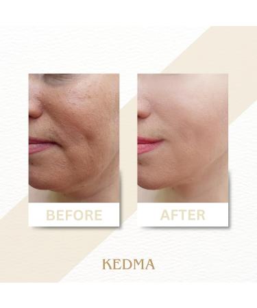 Kedma - Body Butter Lemongrass - Moisturizing Body Butter with Cocoa Butter and Dead Sea Minerals - For Dry Skin - 250g - Buy Online on GoSupps.com