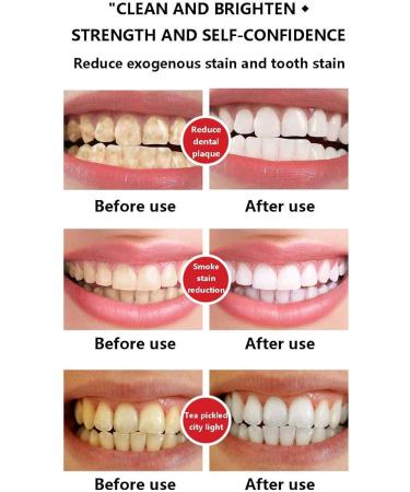 Buy 4TM Probiotic & SP-4 Whitening Toothpaste Set | Super Prebiotic & Stain Removal | International Shipping Available - Buy Online on GoSupps.com