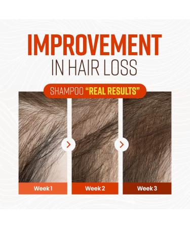 CRAZY SKIN Biotin Beer Shampoo 3.38 fl.oz - Hair Loss & Regrowth Treatment | Sulfate-Free Travel Size Shampoo for Thinning Hair | Beer Yeast Infused for Hair Thickening - 100ml - Buy Online on GoSupps.com