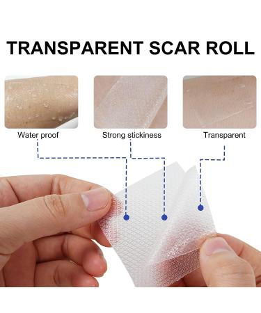Clear Gel Silicone Scar Tape (1.6'' x 120') for Scar Removal - C-Section Surgery, Keloid, Burn, Acne - Silicone Scar Sheets Strips - Buy Online on GoSupps.com