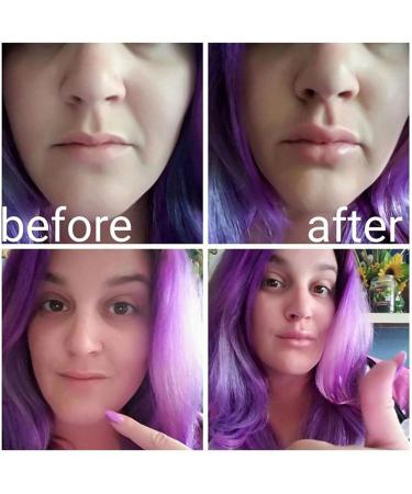 Biudui Lip Plumper - Fish Lips Booster | Silicone Lip Enhancer for Women | Reusable Lip Amplifier & Enlargement Tool - Buy Online on GoSupps.com