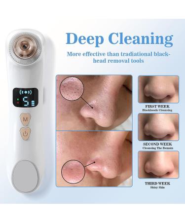 Hohotti Blackhead Remover Vacuum with Camera | USB Rechargeable Pore Vacuum for Face | 6 Suction Heads & 5 Modes | Acne Extractor Tool Kit - Buy Online on GoSupps.com