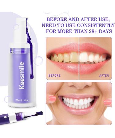 Purple Teeth Whitening Pen Set - Gentle Gel & Foam Kit for Sensitive Teeth | International Shipping - Buy Online on GoSupps.com