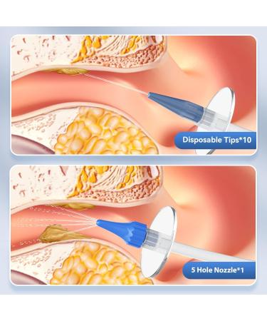 Qimic Ear Wax Removal Kit - Safe & Effective Ear Irrigation Flushing | Complete Cleaning Kit with 10 Replaceable Tips for Home Use - Buy Online on GoSupps.com