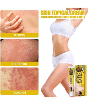 Revitaskin Herbal Eczema Psoriasis Cream - Eczema Relief for Adults (2 pcs) - Buy Online on GoSupps.com