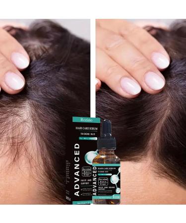 higyee Liquid Biotin Organic Hair Growth Essence Powerful Vitamin B Supplement Strong Nails and Healthy Skin Extra Strength Gel Drops 1 OZ for Women and Men - Buy Online on GoSupps.com