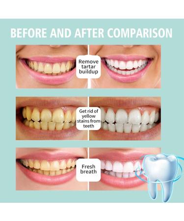 Teeth Total Care Mouthwash - Whitening Foam Bad Breath Eliminator 3PC Oral Care Solution for Deep Cleaning & Fresh Breath - Buy Online on GoSupps.com