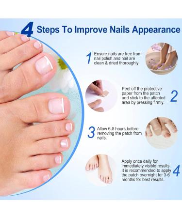 Fungal Nail Treatment - Extra Strong Toe Nail Repair Patches for Damaged Nails - 8 Hour Nail Repair Restores Healthy Nails - Buy Online on GoSupps.com