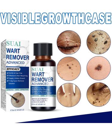 Aimery Wart Remover Liquid | Gentle Botanical Formula for Plantar Common & Flat Warts - Safe & Effective International Shipping - Buy Online on GoSupps.com