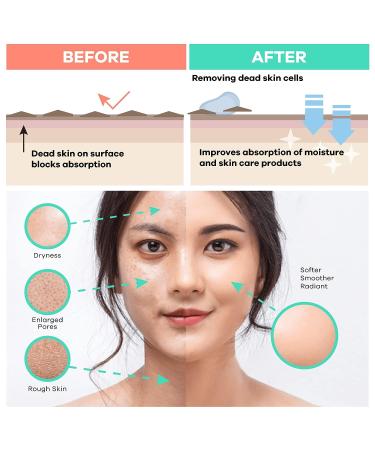 Dermasuri Deep Exfoliating Face and Body Scrub Mitt - Best Skincare Kit for Women & Men - Gentle Facial Exfoliation Tool - Buy Online on GoSupps.com
