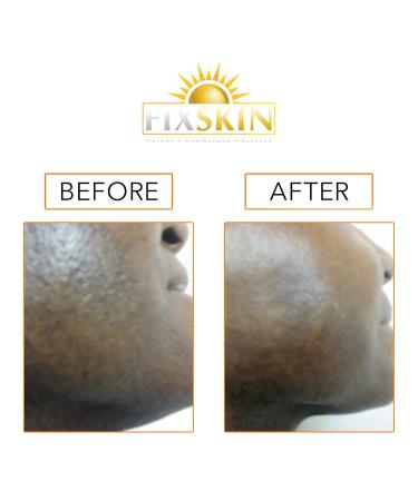 Razor Bump Removal Duo - Fast & Effective International Shipping | Smooth Skin Solution - Buy Online on GoSupps.com