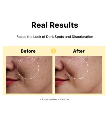 DearMYDEW 5% Tranexamic Acid Serum with 5% Niacinamide Bakuchiol Dark Spot Correcting Serum Fade Discoloration Hyperpigmentation Acne Scars Sun Spots Blemish Remover Korean Skincare 1Fl Oz - Buy Online on GoSupps.com
