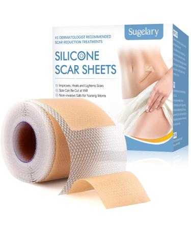 Silicone pavement for scars professionally scar patches for scars through C section operations burns keloid acne and more stock for 6 8 months silicone scarb roll (4CMX150cm)