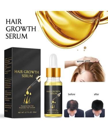 Hair Growth Oil Strong Hair Regrowth Serum Organic Hair Regrowth Kit Ginger Germinal Oil For Thicker Stronger Healthier Hair - Buy Online on GoSupps.com