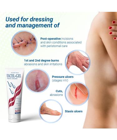 MPM Excel-Gel Hydrogel Dressing 1oz - Nontoxic & Sterile - Buy Online on GoSupps.com