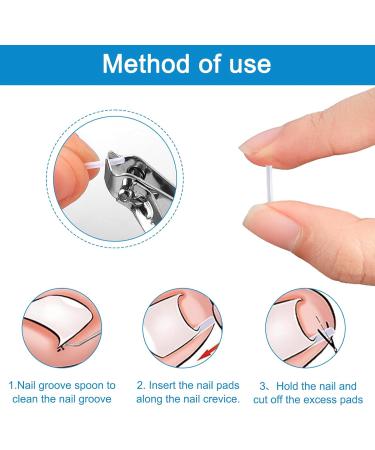 Ingrown Toenails Set Toenail Correction Patch Nail Clip Toenails Ingrown Toenails Toenail Correction with Lifter for Ingrown Toenails 40 Pieces - Buy Online on GoSupps.com