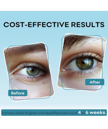Buy Anti-Wrinkle Eye Cream | Firming & Anti-Aging Treatment for Dark Circles | 1.06 oz - Buy Online on GoSupps.com