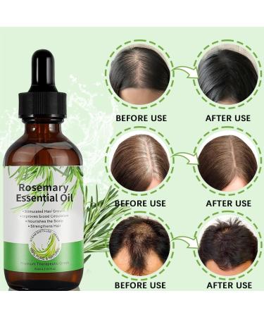 Huile de romarin pour la croissance des cheveux renforce les cheveux nourrit le cuir chevelu 2 x 60 ml - Buy Online on GoSupps.com