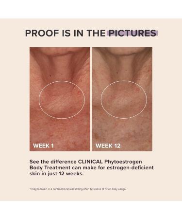 Paula's Choice Clinical Phytoestrogen Body Treatment - Restore Elasticity & Firmness for Thinning Skin Fragrance-Free Cream for Chest & Decollete 3.3 Fl Oz - Buy Online on GoSupps.com