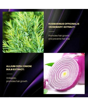 Shampoing l'oignon shampooing bio pour la croissance des cheveux enrichi en huile d'oignon et de rosema nettoyant doux hydratant pour le cuir chevelu brillance douce anti-perte de cheveux et - Buy Online on GoSupps.com