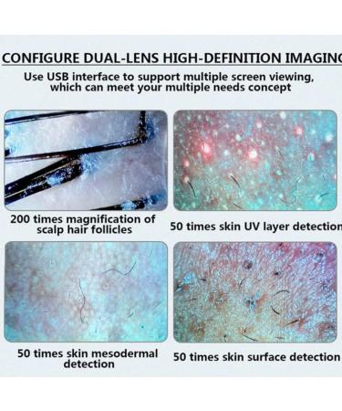 Skin Diagnosis Hair Analyzer 10.1inch Screen Multi Functional High Definition Rechargeable Skin Scalp Hair Follicle Detector High Sensitivity Digital Hair Follicle Skin Analyser Machine - Buy Online on GoSupps.com