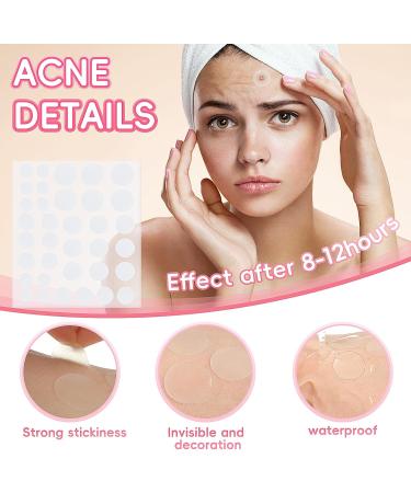 Acne Pimple Patch 226 Dots Star Pimple Patches Spot Stickers - Tea Tree Oil & Centella Oil - Effectively Calms & Relieves Acne - for Pimples Blemishes Zits Acne - Buy Online on GoSupps.com