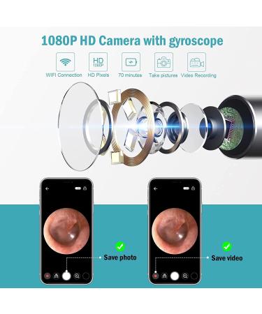Ear Wax Removal Tool with 1080P Camera and Light - Ear Cleaner Kit for iPhone, iPad, Android - Professional Ear Cleaning at Home - Buy Online on GoSupps.com
