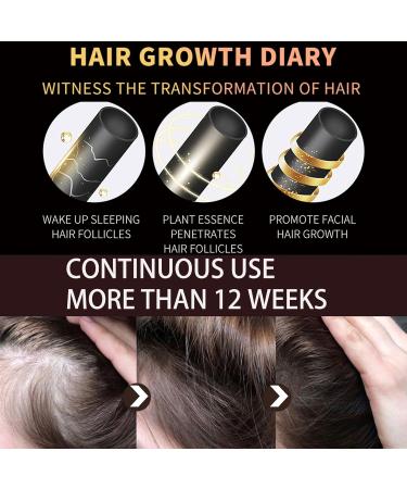 Hair Growth Oil Thinned Hair Liquid Grow Hair Deeply Nourishing Scalp Stimulates Hair Growth Trengthen Hair Roots Moisturize & Repair Dry Damaged Hair Care Hair Growth Serum for All Hair Types - Buy Online on GoSupps.com