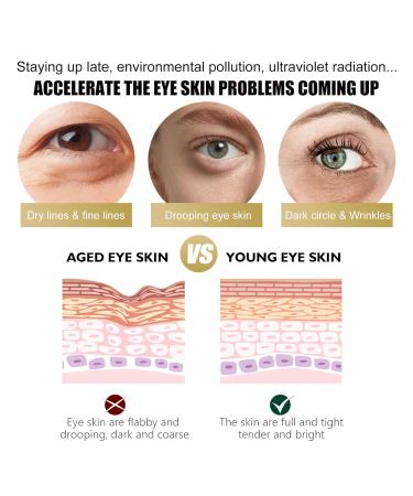 Retinol Eye Cream Stick Lightens Eye Bags Dark Circles Eye Lines Hydrates Moisturizes Firms Eye Area Skin - Buy Online on GoSupps.com