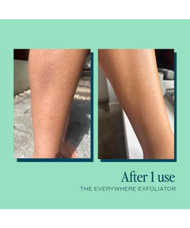 Everywhere Exfoliator 180ml | Natural Vegan Body Scrub with Glycolic & Lactic Acid | Hydrating AHA Formula with Vitamin E | Gentle Daily Use | pH Balancing | Travel Size - Buy Online on GoSupps.com