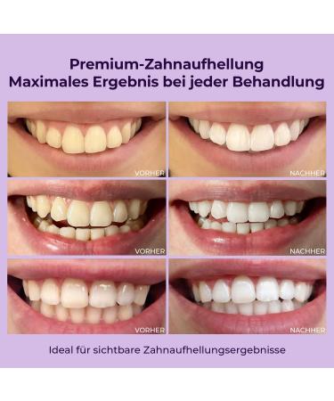 ONLYSMILE Teeth Whitening Gel | Instant Tooth Bleaching & Whitening | Cosmetic Tooth Cleaning for Bright White Teeth - Buy Online on GoSupps.com